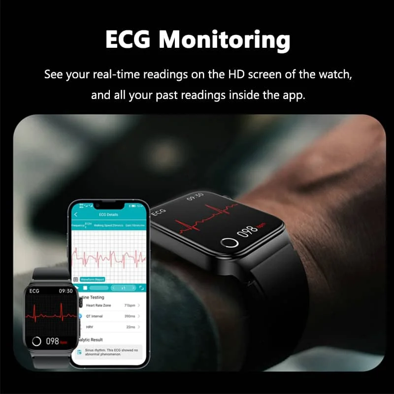 E500 Smartwatch: Blood Glucose & ECG Heart Monitoring, IP68 Waterproof